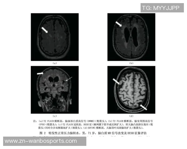 约维奇重摔受伤退场X光检查结果无异常明日将进行MRI检查评估伤情